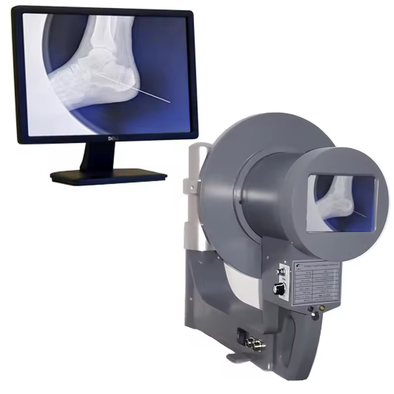 Portable X-ray Systrm